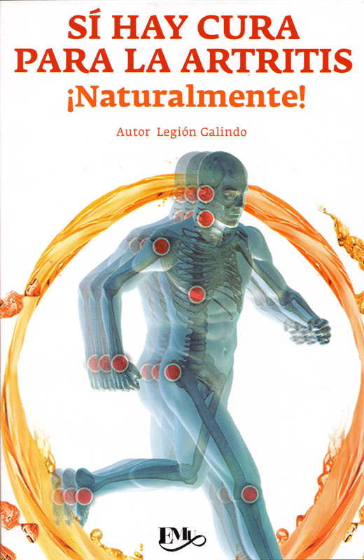 Sí hay cura para la artritis